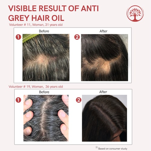 visible result of best hair oil for white hair