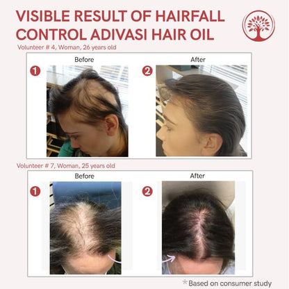 Visible result of adivasi hair oil for baldness