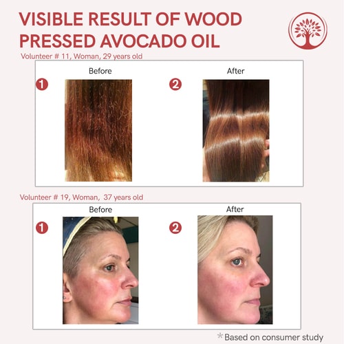 visible result of avocado oil for skin tightening