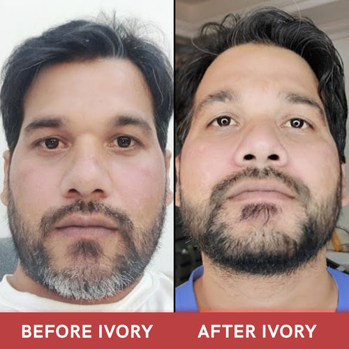 Ivory Natural - Grey beard Combo Before & After